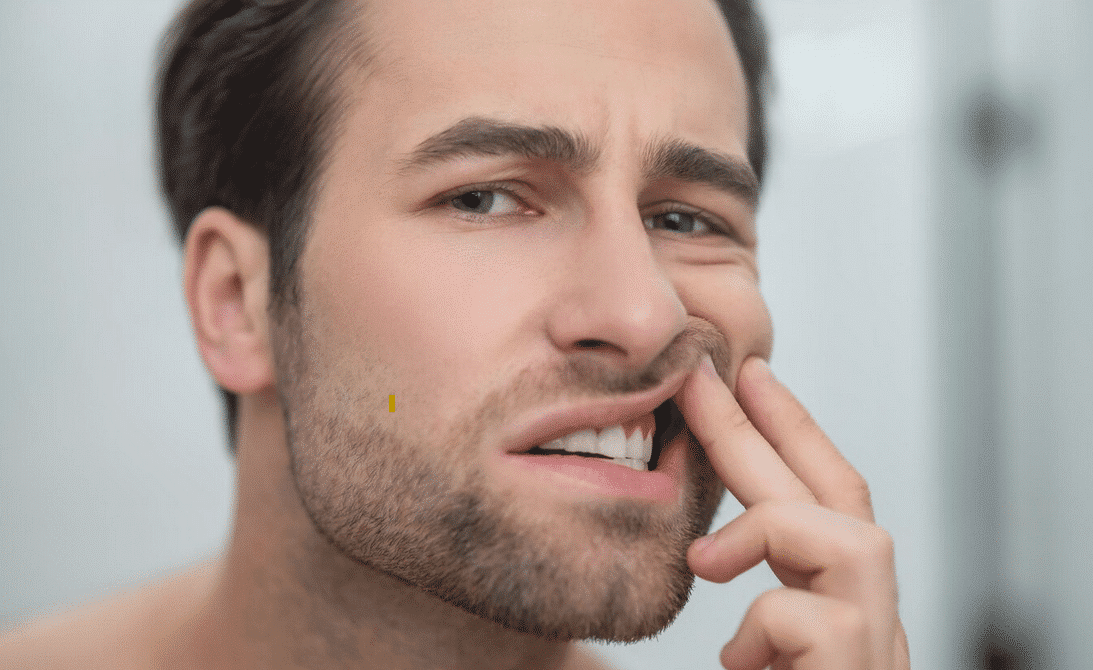 Gingivito gydymas natūraliai