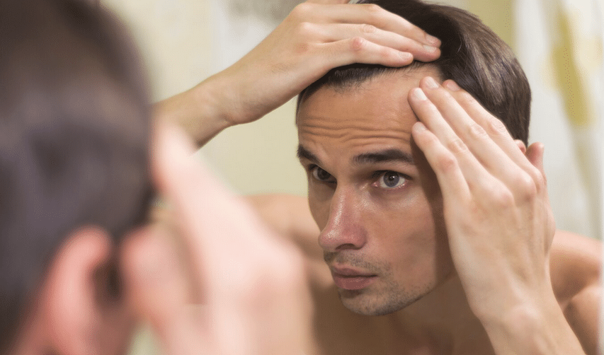 Alopecija