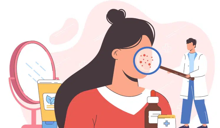 angioedema kas tai