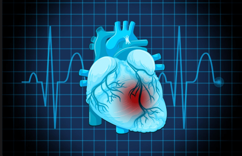 cholesterolio rysys su insultu